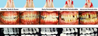 Difa Oral Health Center "Jaga Mulutmu! "