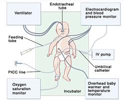 Mengenal NICU dan Inkubator Mengenal NICU dan Inkubator