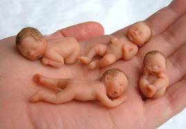 Aborsi Aborsi
