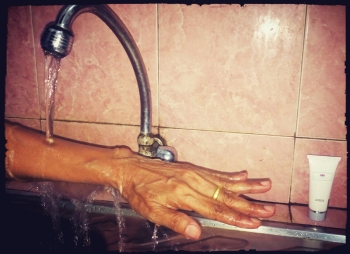 Pertolongan Pertama Mata Terkena Minyak Panas - Berbagai Mata
