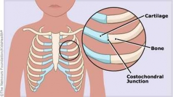 Gambar Orang Sakit Sesak Nafas Gambar Orang Sakit Sesak Nafas