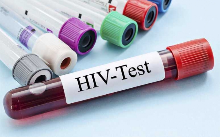 Hasil Tes HIV Suami Positif tapi Istri Belum Beritahu Hasil Tes HIV Suami Positif tapi Istri Belum Beritahu