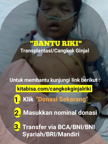 100+ Gambar Alat Cangkok Ginjal Terlihat Keren 100+ Gambar Alat Cangkok Ginjal Terlihat Keren
