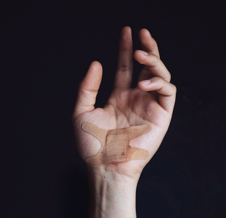 Cara Cepat Obati Luka Agar Tidak Infeksi Kompasiana Com