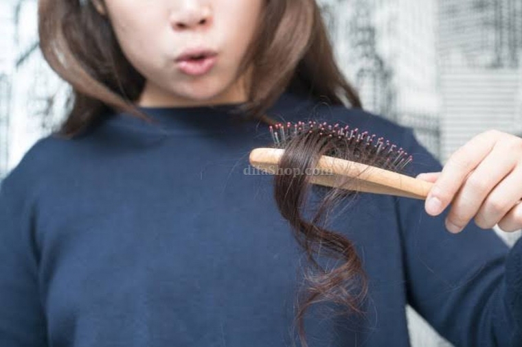 Jenis Rambut Rontok Penyebab Dan Cara Alami Mengobati Halaman All Kompasiana Com