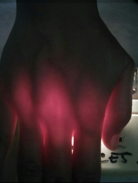 Dengan Keterbatasan Alat, Pemuda Ini Mampu Ciptakan Pendeteksi Pembuluh Darah (Vena) Balita