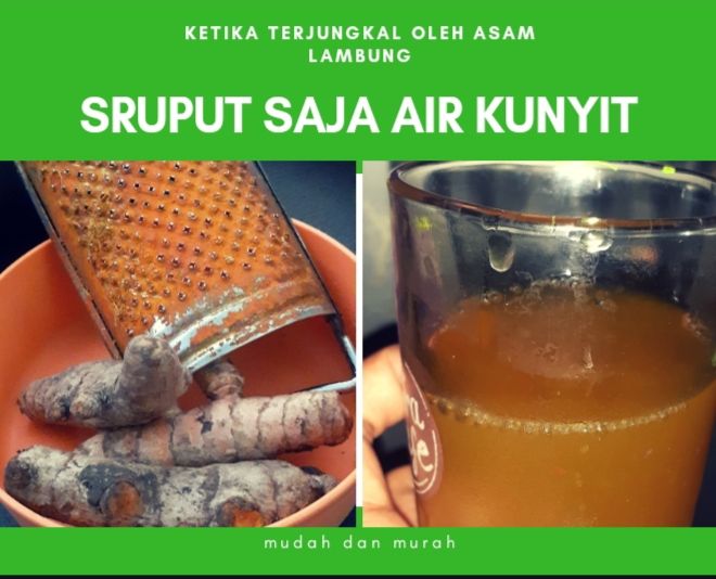 Ketika Terjungkal oleh Asam Lambung, "Sruput" Saja Air Kunyit