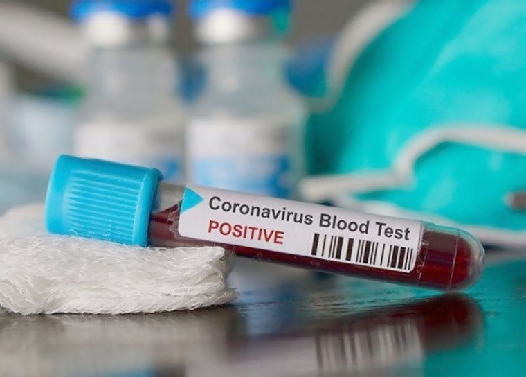 WHO Ingatkan Bekas Penderita Covid-19 Agar Jangan Terlalu Yakin Tidak Tertular Lagi