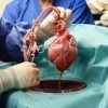 Transplantasi Jantung Babi, Bukti Kedigdayaan Rekayasa Genetika