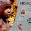 Monkeypox 2022: Virus Cacar Monyet Mulai Mewabah di Sejumlah Negara