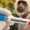 Cacar Monyet Berpotensi Jadi Pandemi Selanjutnya? Ini Beberapa Hal yang Perlu Kita Lakukan