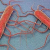 Bakteri Listeria Kian Meningkat, Begini Ciri Gejalanya dan Cara Antisipasinya