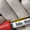 Webinar PERDOSRI: KLB Polio, Gejala, dan Manajemen Rehabilitasi Medis