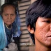 Belajar dari Tiko: Kisah Anak yang Merawat Ibu Pengidap Penyakit ODGJ