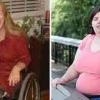 Fenomena Transable, Memilih Menjadi Disabilitas Akibat Disforia