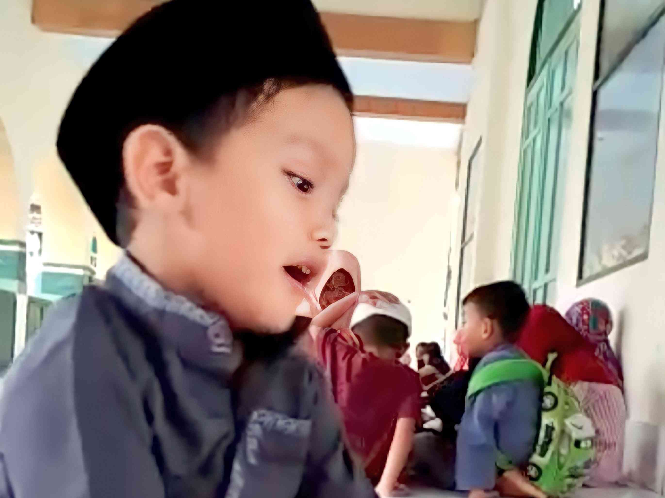 Empat Strategi Menjaga Kesehatan Kulit Anak Saat Puasa