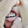 Mengenal "Nursing Bottle Caries" untuk Mencegah Kerusakan Gigi Anak