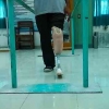 Pasien Amputasi Bawah Lutut di Indonesia Perlu Prostesis yang Nyaman