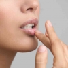 Penyebab dan Cara Mengatasi Bibir Kering Pecah Pecah