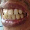 Tips dan Solusi Masalah Gigi dan Mulut yang Sering Terjadi Saat Puasa