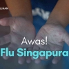 Awas! Flu Singapura di Musim Mudik Lebaran, Jangan Lengah